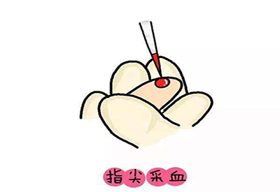 儿童91麻豆国产福利在线观看微量元素的检测项目有哪些