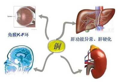 人体麻豆视频在线网站数据能够准检测出但身体中微量元素铜超标会引起疾病发生